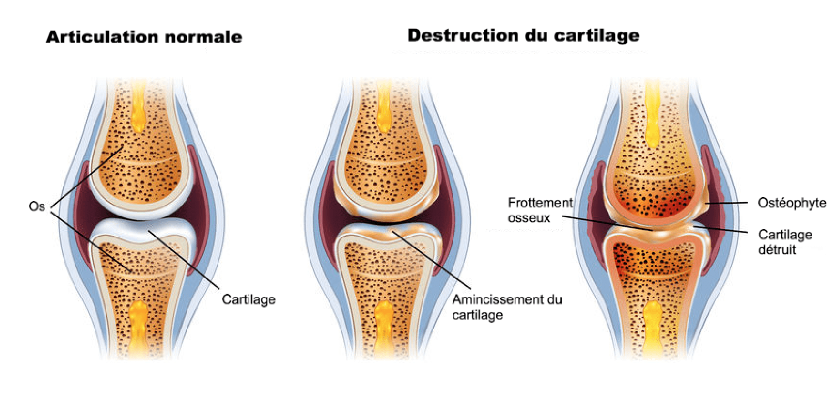 L'arthrose chez le chat et le chien