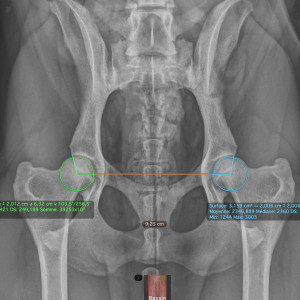 La dysplasie de la hanche 2ème partie : diagnostic radiologique