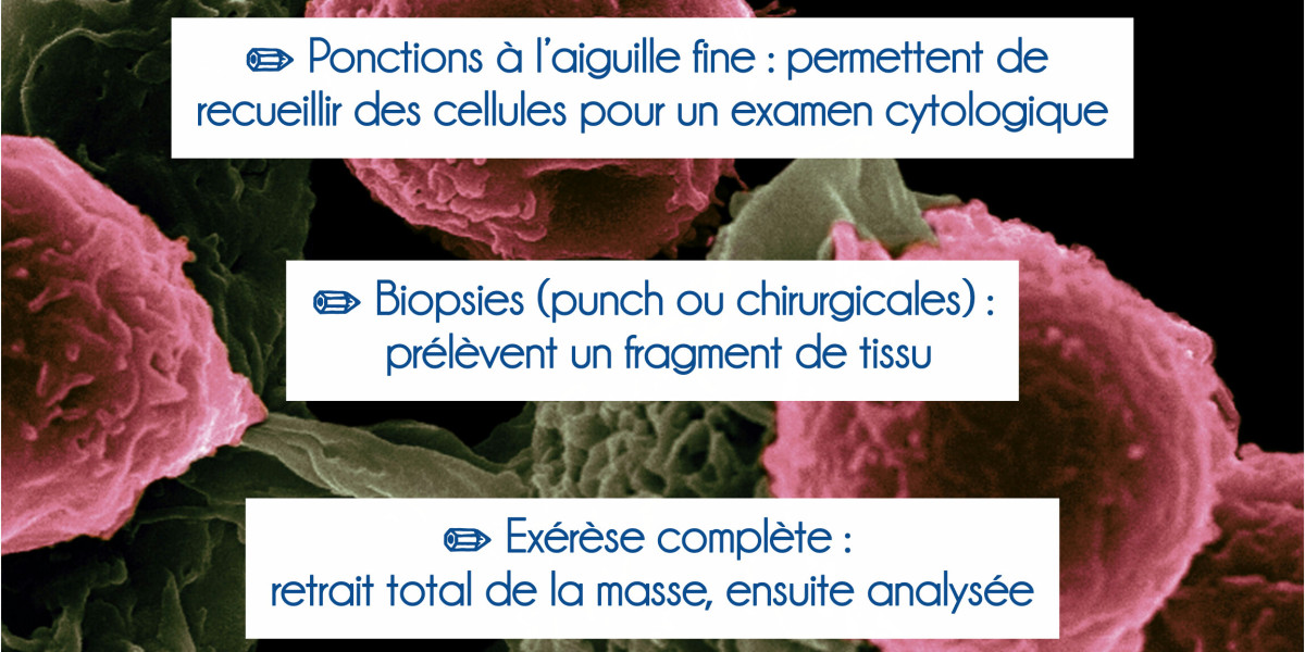 🔎🩺Dépistage tumorale