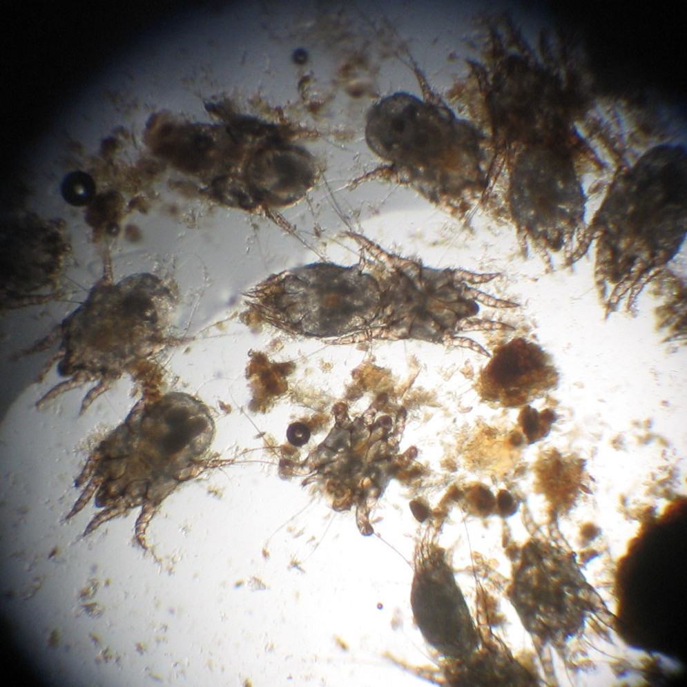 Examen de poils au microscope