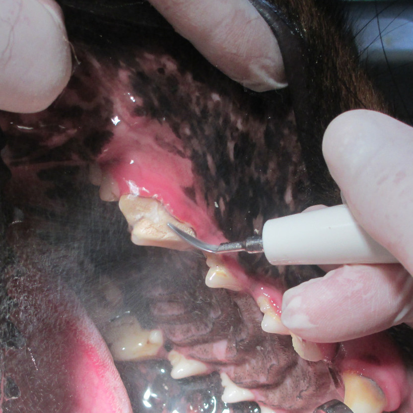 Le détartrage et les soins buccodentaires