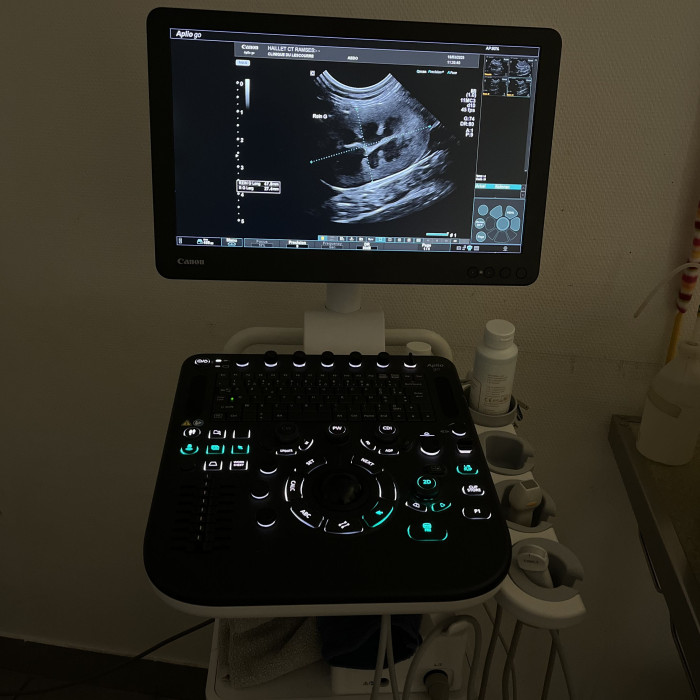 Echographie abdominale